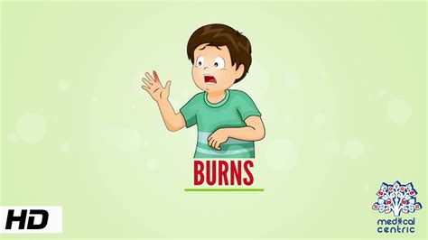 YouTube 0:00 / 46:45 Burns nursing care NCLEX review lecture covers burns treatment, pathophysiology, nursing interventions, degrees of burns (1st, 2nd, 3rd, and 4th degree burns. . Purns video